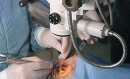 Хирургическая коррекция птоза века в Израиле